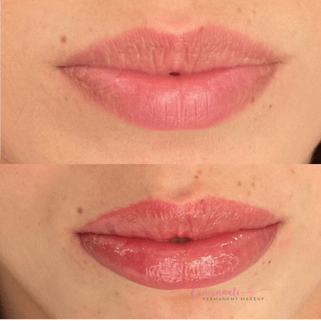 Lip blushing before and after results showing beautifully tinted and defined lips.