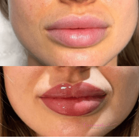 Lip blushing before and after results showing beautifully tinted and defined lips.